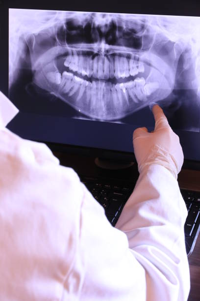 Best Emergency Dental Care for Broken or Chipped Teeth in Pine Grove Mills, PA